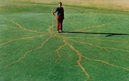 被闪电击中留下的“刺青图案” 永久性伤疤当纪念品