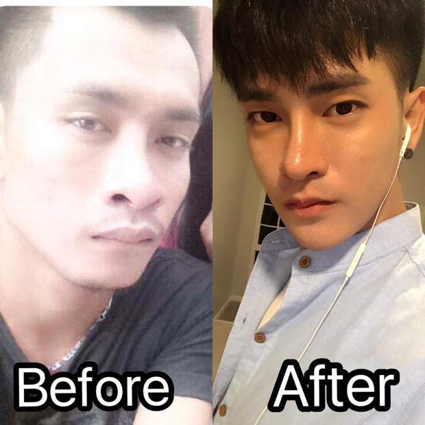 泰国男子容貌太丑找工作屡遭拒绝 整容成韩国男星帅脸工作找上门