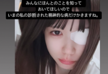 凉宫琴音：就算是这样，我也很努力地活着。【EV扑克官网】